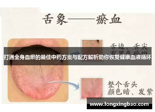 打通全身血瘀的最佳中药方案与配方解析助你恢复健康血液循环